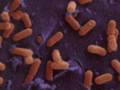 Bacterias Patogenas